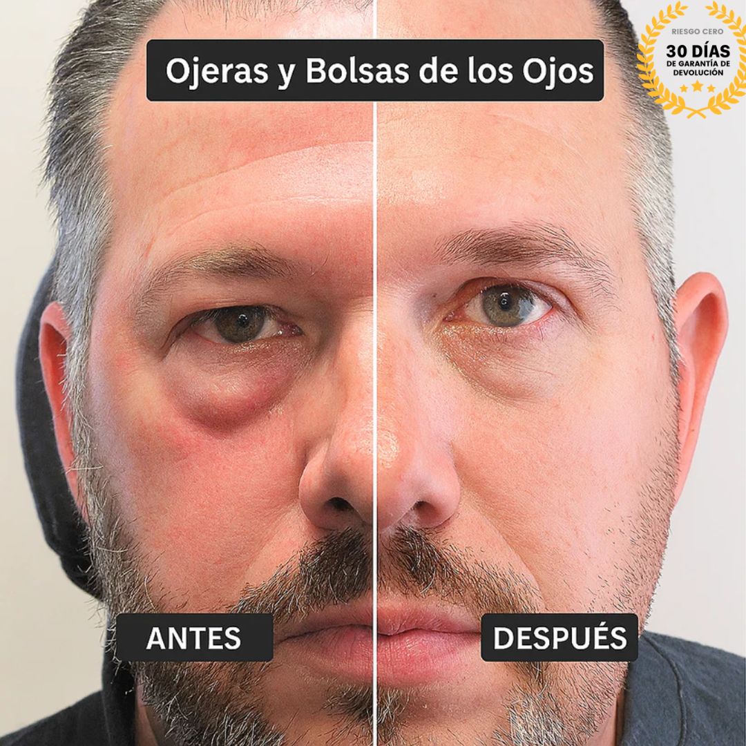 Surogatu™ - Borrador de Ojeras